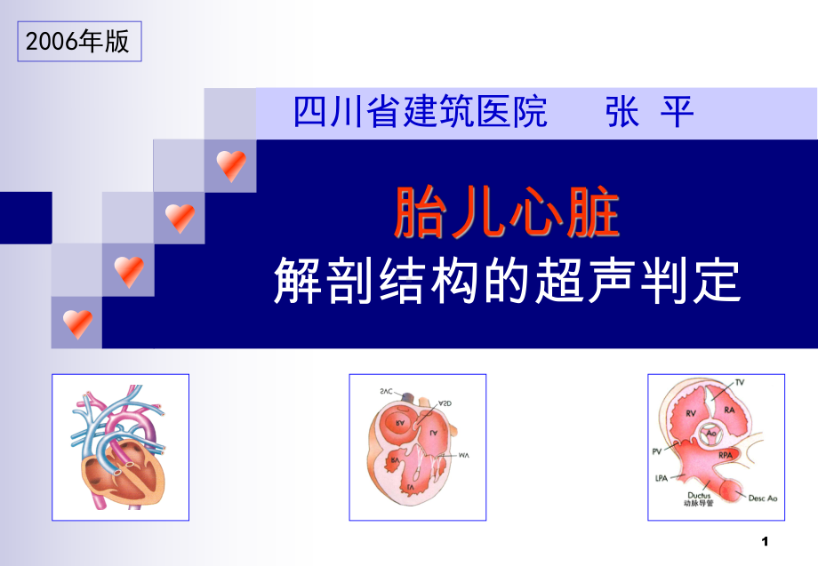 新版胎儿心脏解剖结构的超声判定课件.ppt_第1页