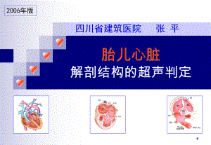 新版胎儿心脏解剖结构的超声判定课件.ppt