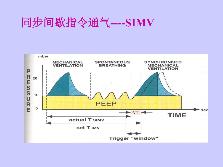 机械通气基础及基本临床应用2课件.ppt_第2页