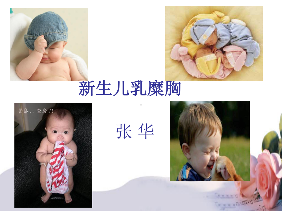 乳糜胸查房课件.ppt_第1页