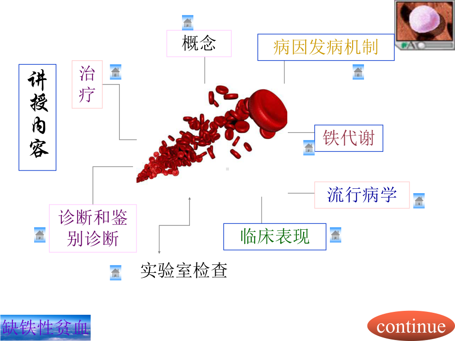 缺铁性贫血课件讲义.ppt_第2页