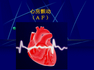 房颤(业务学习)课件.ppt