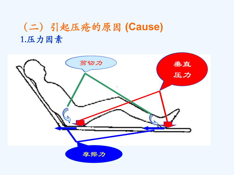 压疮分期及预防措施课件.ppt_第2页