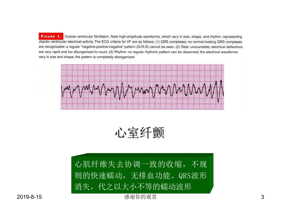 复苏技术发展的重要概念模板课件.pptx_第3页