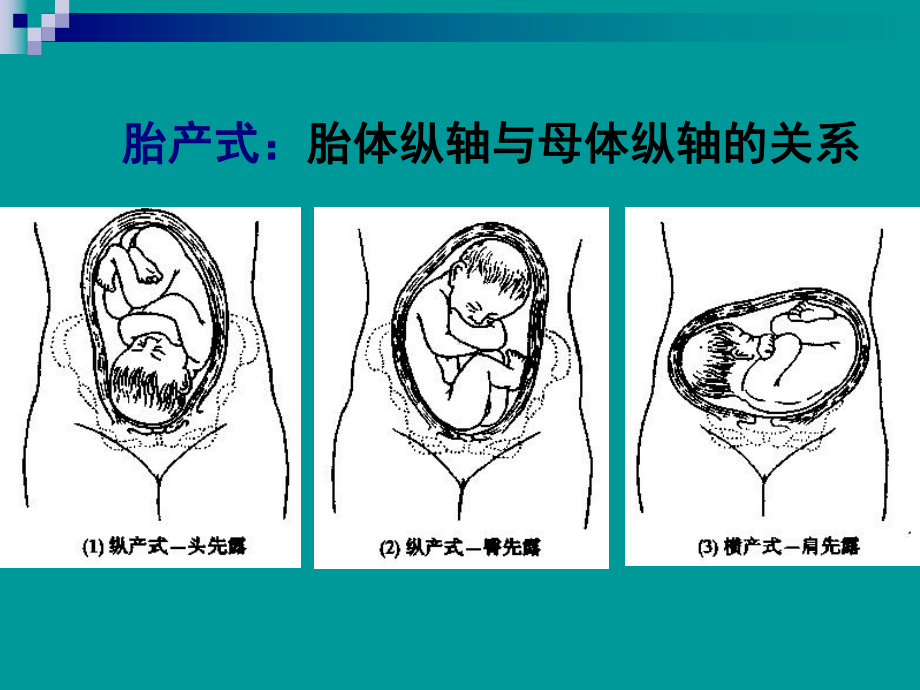 分娩过程的观察及护理课件.ppt_第3页