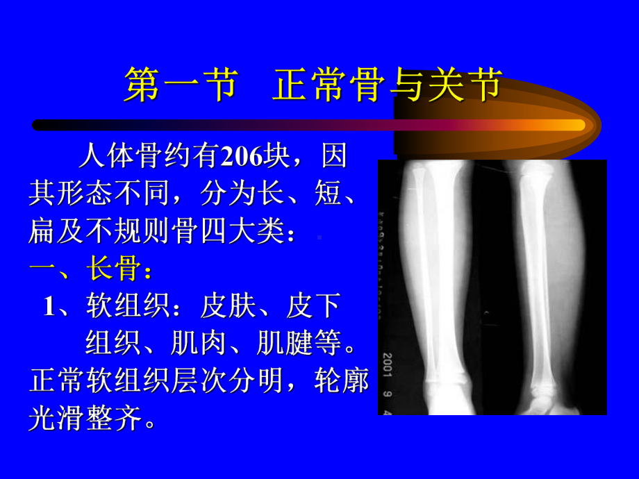 正常骨与关节课件.ppt_第2页