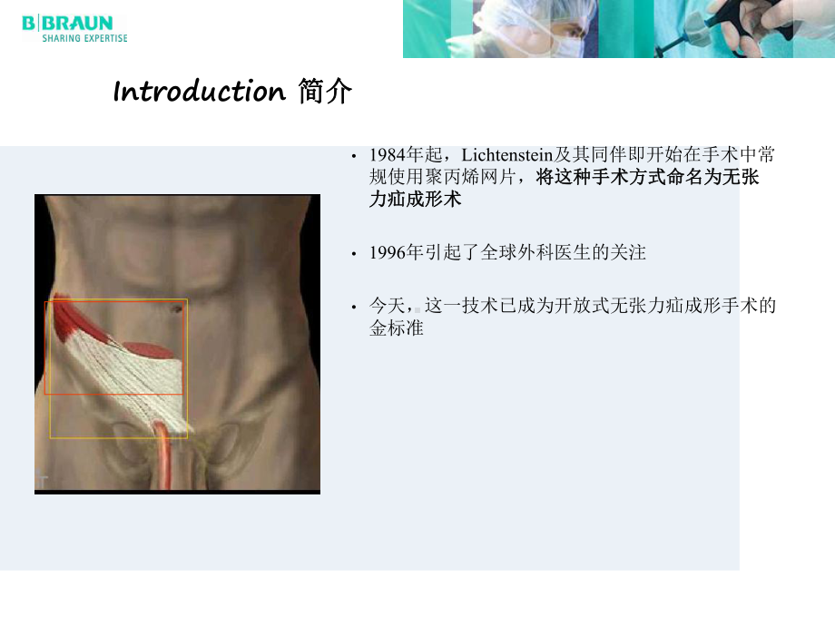 李金斯坦无张力疝手术方法步骤课件.ppt_第2页