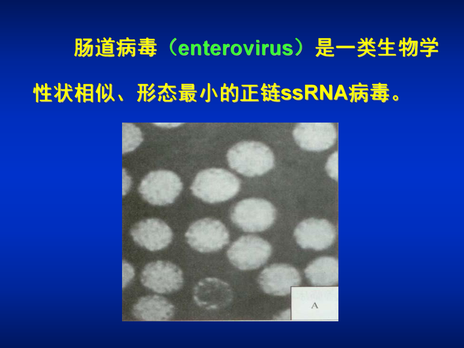 医学微生物学第27章肠道病毒课件.ppt_第2页