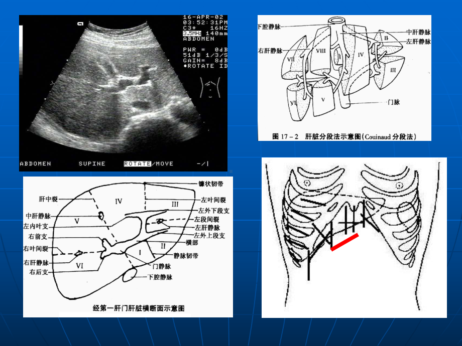 腹部超声解剖课件.ppt_第2页