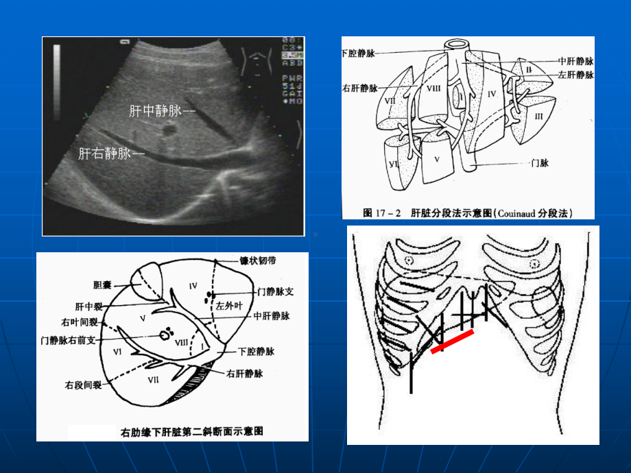 腹部超声解剖课件.ppt_第3页