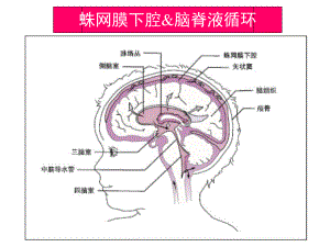 珠江蛛网膜下腔出血课件.ppt