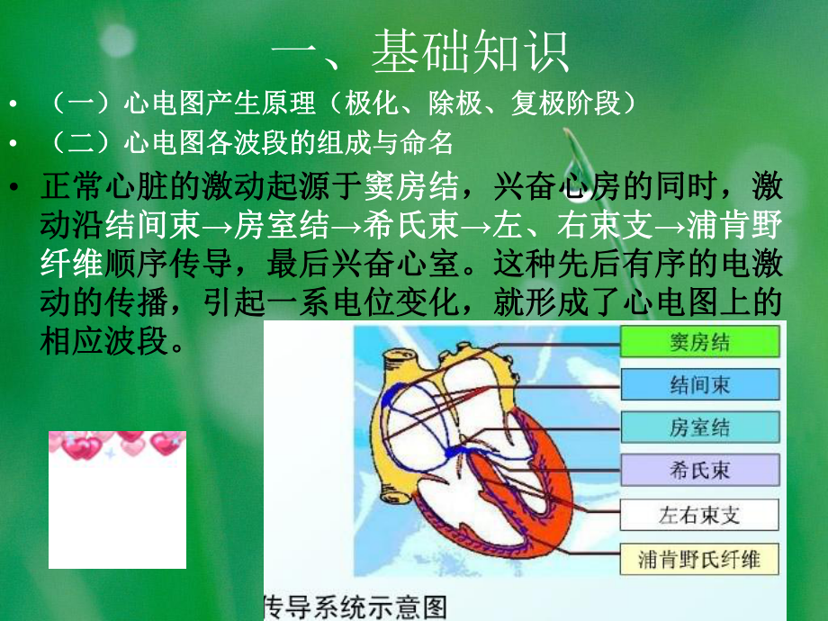 新生儿心电监护技术及异常心电图的识别课件.ppt_第3页