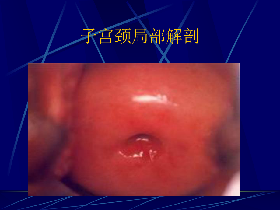 子宫颈和子宫腔手术副本课件.ppt_第2页