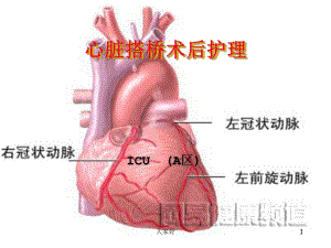 心脏搭桥课件.ppt