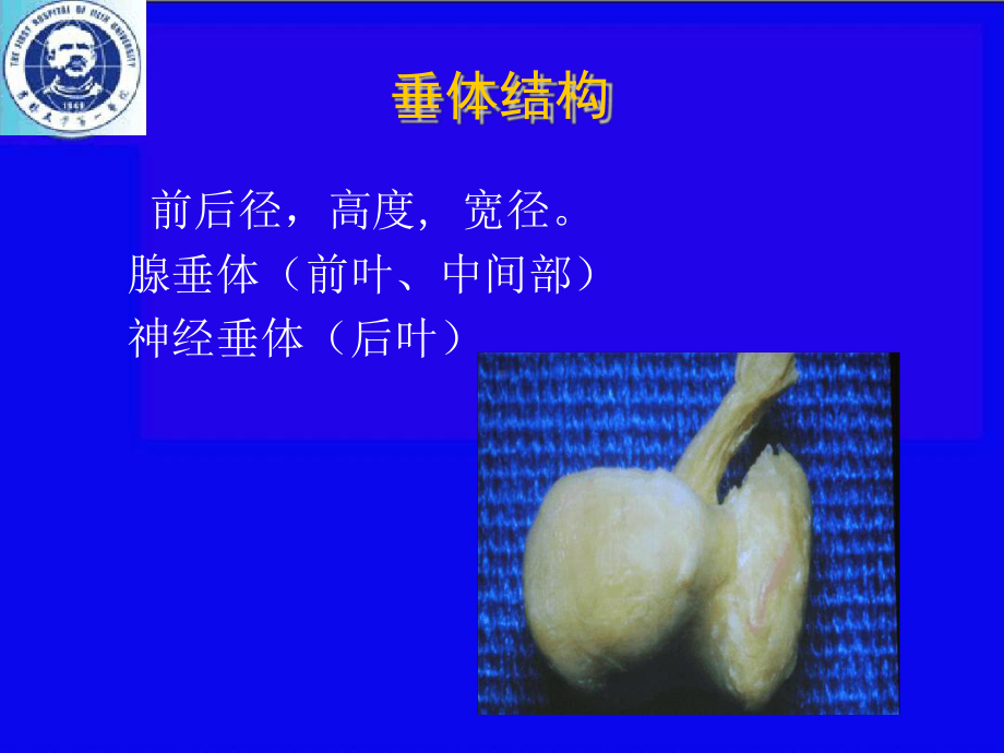 垂体危象的预防临床表现及治疗课件.ppt_第3页