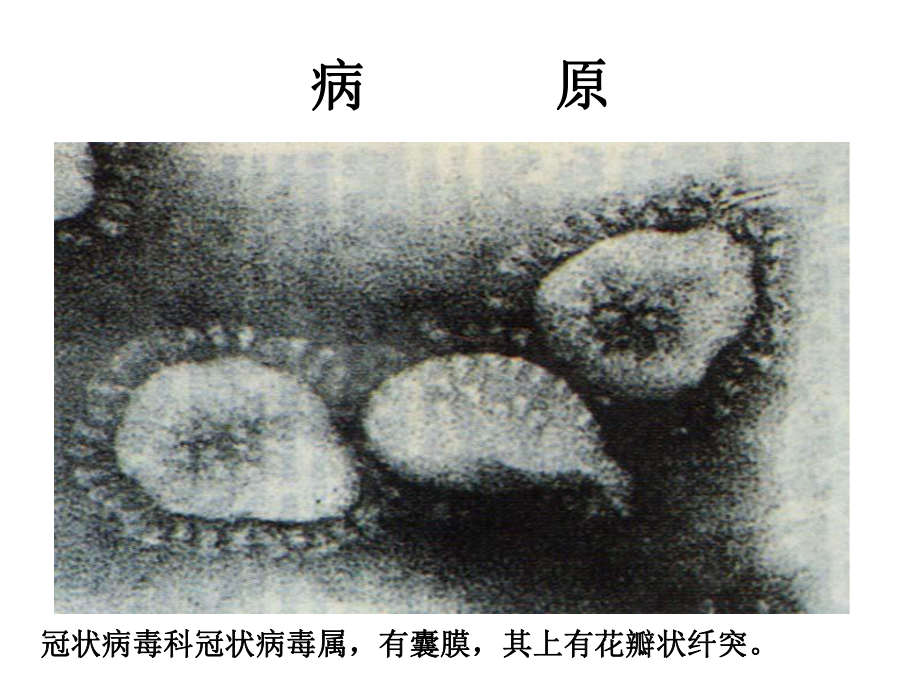 禽类传染病IB传染性支气管炎课件.ppt_第3页