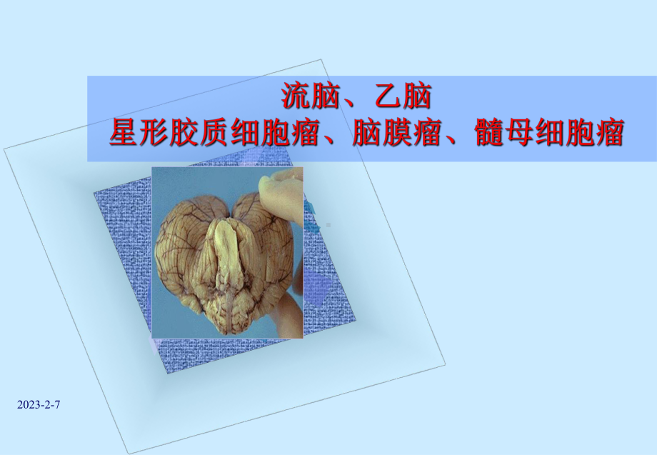 神经系统疾病病理学教研室课件.ppt_第1页