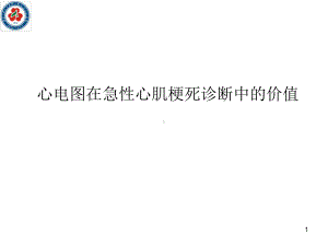 心电图在急性心肌梗死诊断中的价值课件.ppt