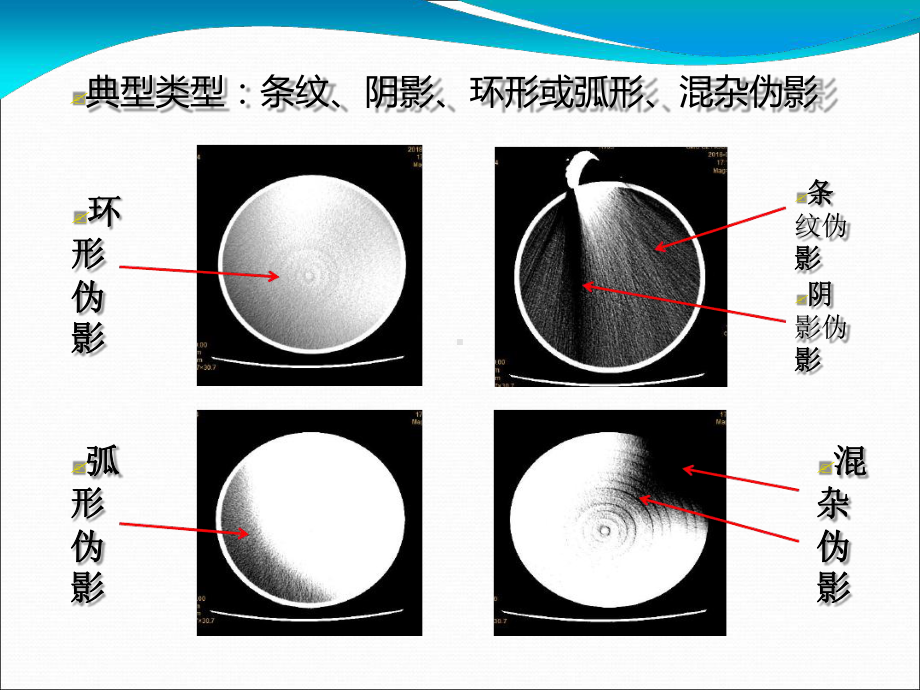 由受检者引起的CT伪影最终课件.ppt_第3页