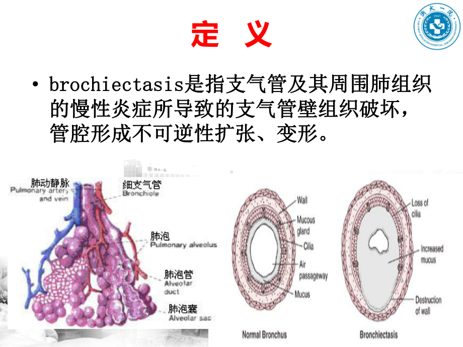 潘志杰支气管扩张课件.ppt_第3页