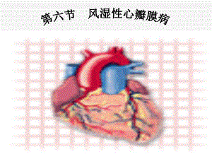 内科护理学课程课件17心脏瓣膜病.ppt