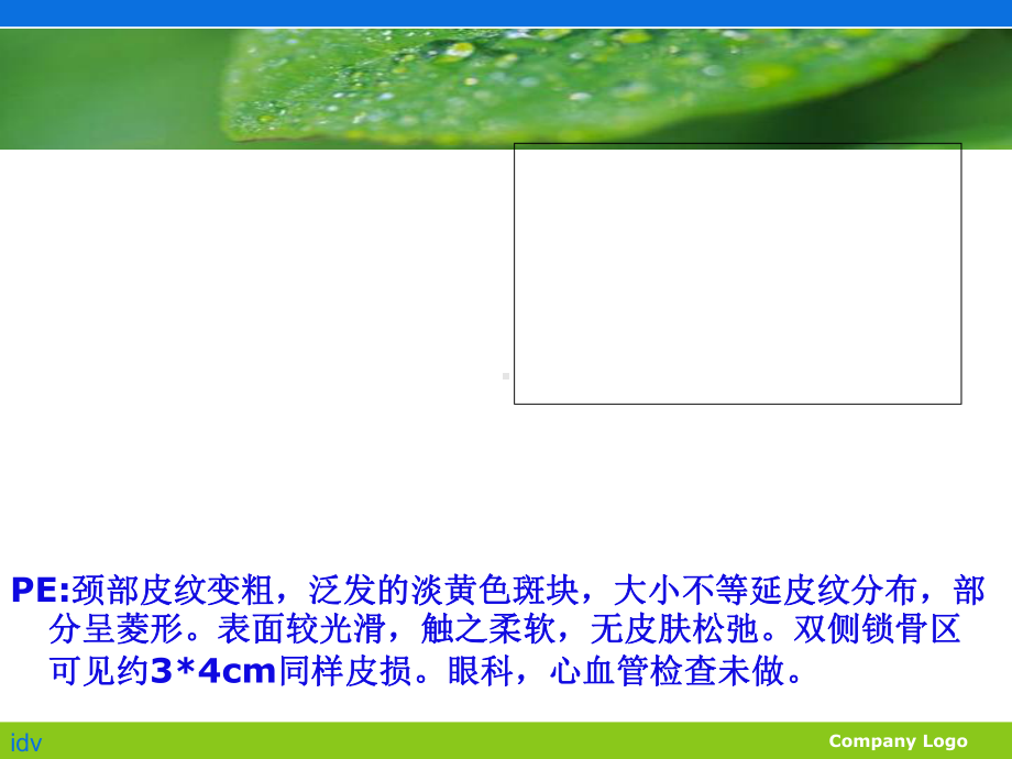 弹性纤维性假黄瘤课件.ppt_第2页