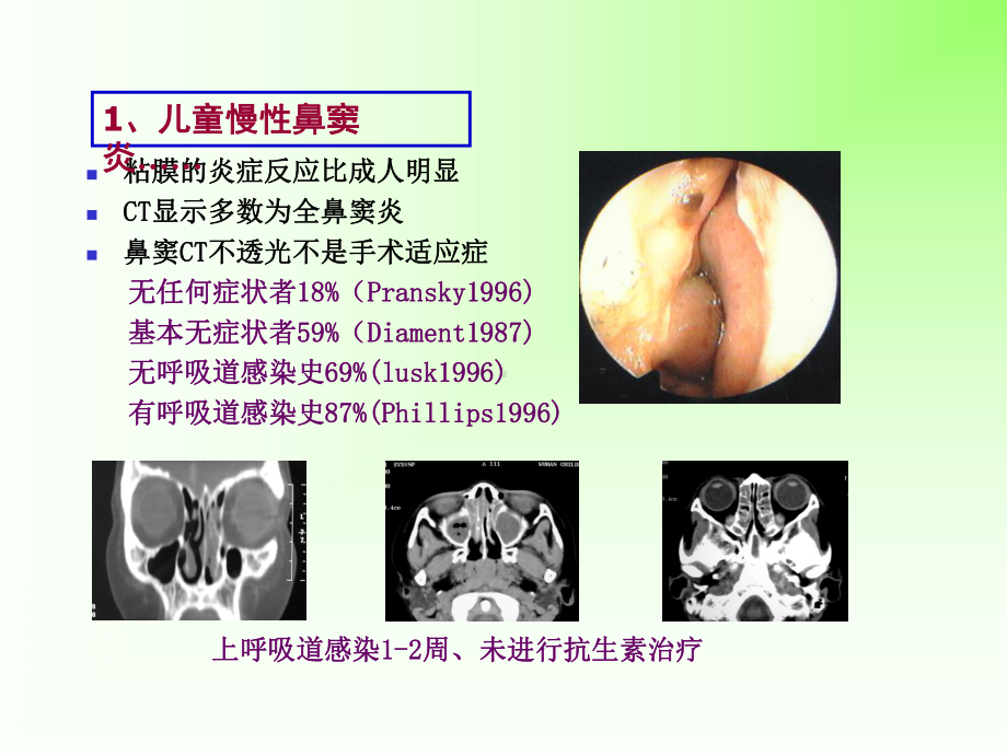 儿童鼻窦炎课件.ppt_第3页