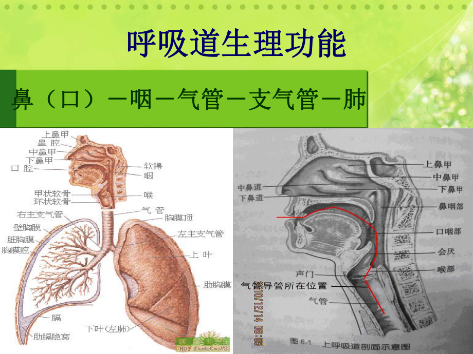 气管切开护理16722课件.ppt_第3页