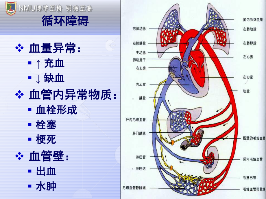 第四章局部血液循环障碍课件.ppt_第3页