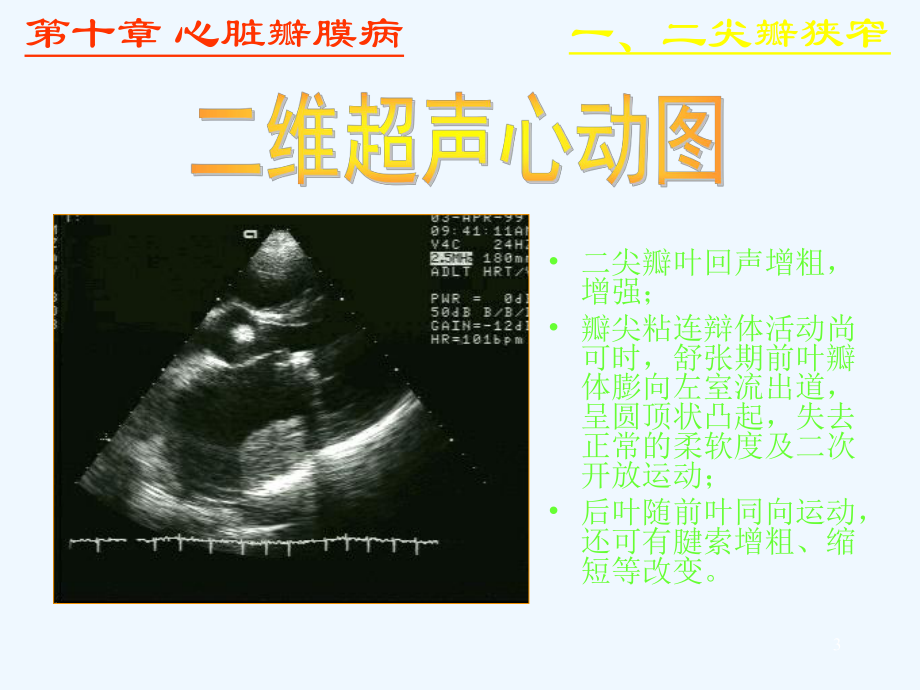 心脏彩超诊断课件.ppt_第3页