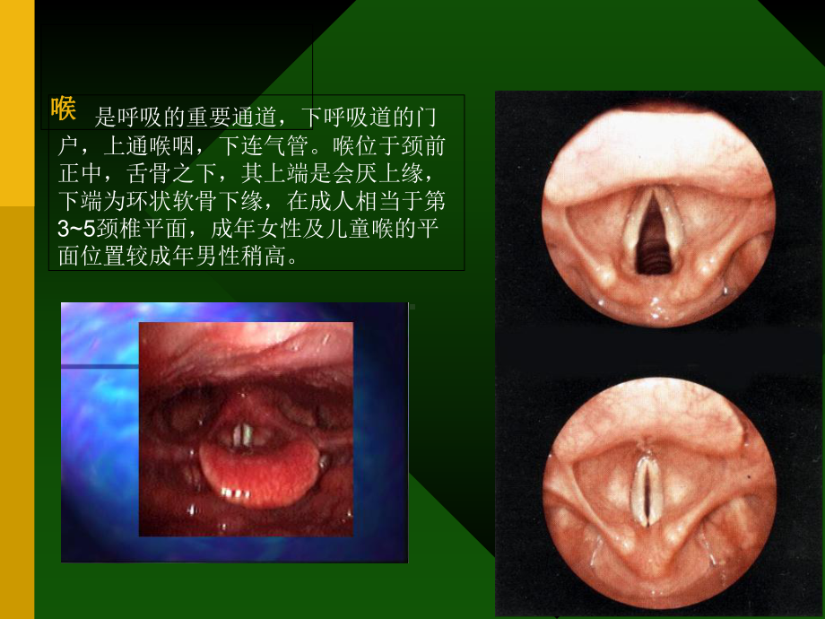 喉阻塞与气管切开相关知识课件.ppt_第3页