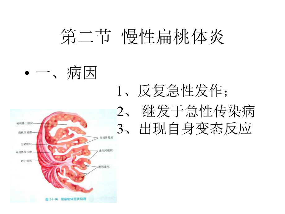 禁忌症1急性扁桃体炎发作时课件.ppt_第1页