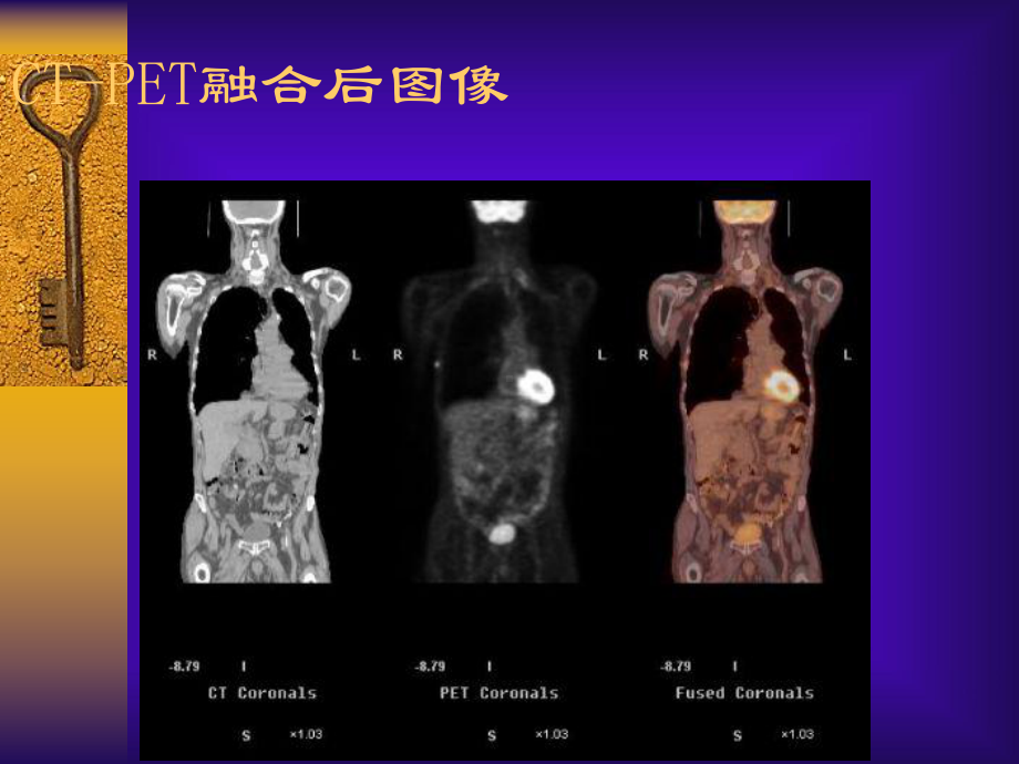 数字信号处理数字相关和数字卷积课件.ppt_第3页