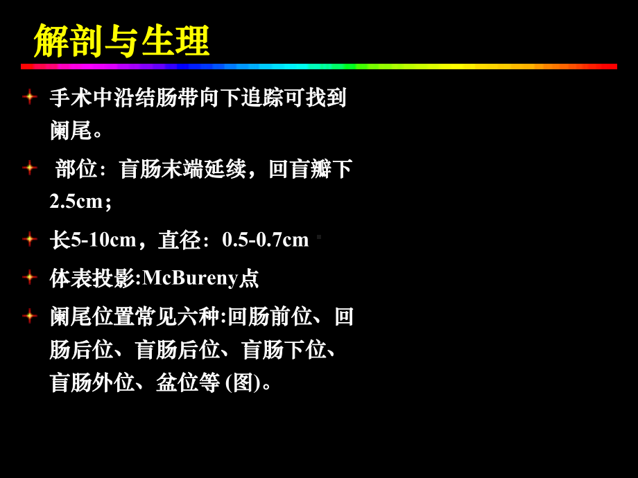 急性阑尾炎一点通 课件.ppt_第2页