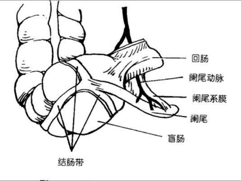 急性阑尾炎一点通 课件.ppt_第3页