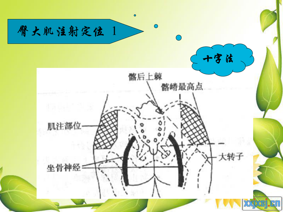 实验课臀大肌注射课件.ppt_第2页