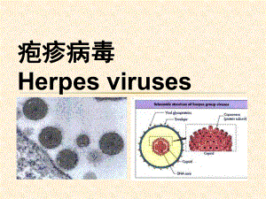 疱疹病毒完整2课件.ppt