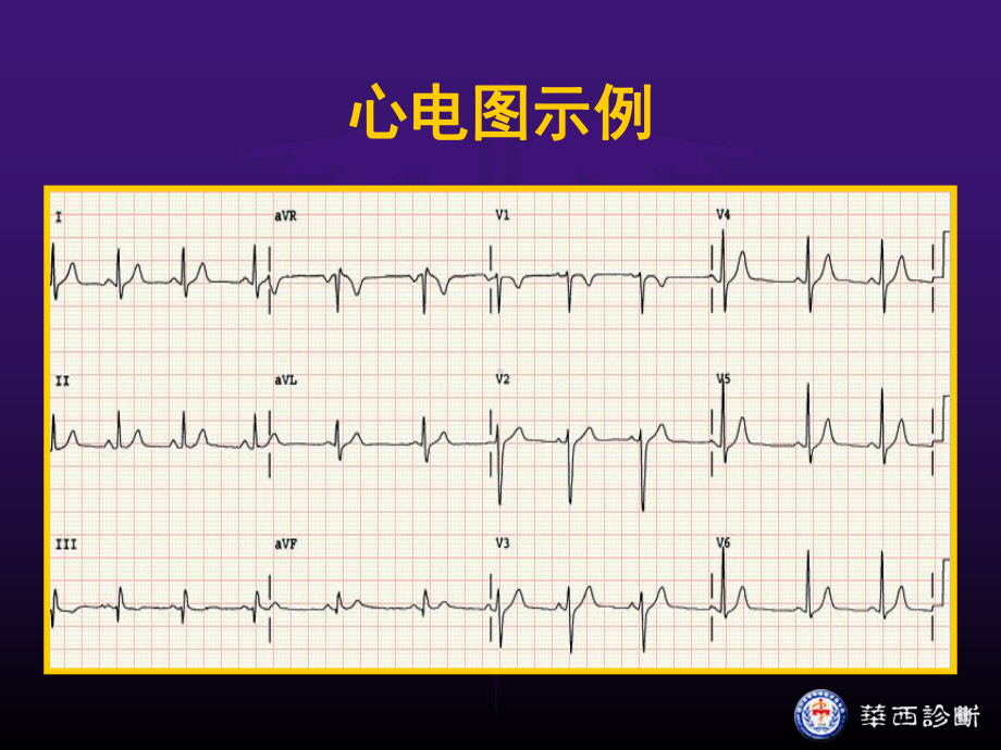 四川大学华西医学院-心电图学课件.ppt_第3页