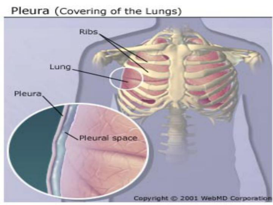 胸水教学幻灯课件.ppt_第3页