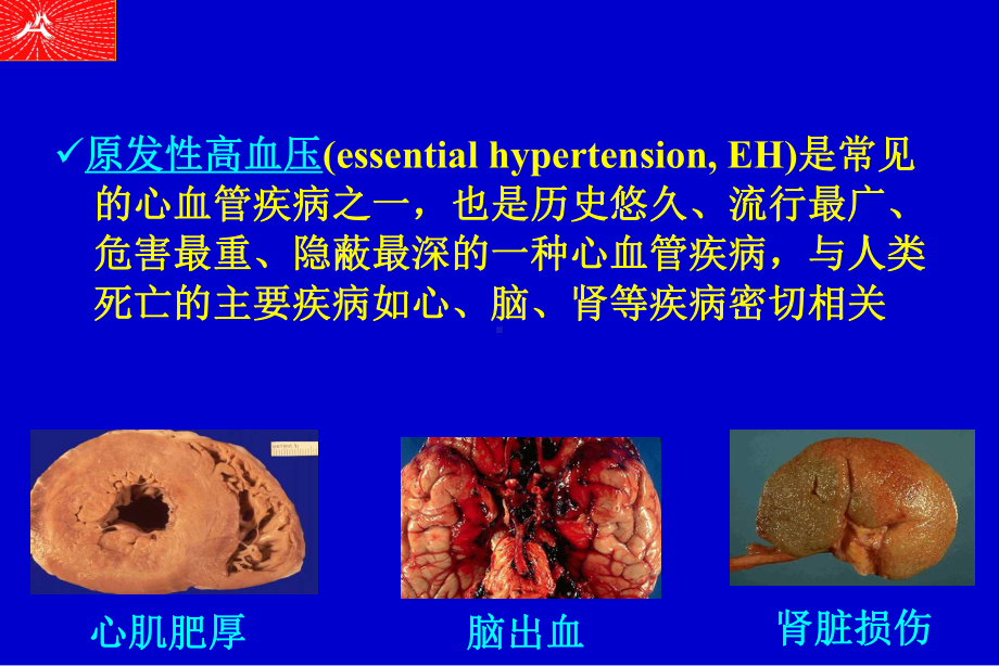 原发性高血压研究的新进展 线粒体基因突变在原发性高血压91课件.ppt_第2页