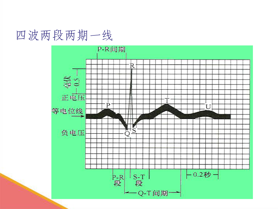 心电图基础知识1课件.ppt_第2页