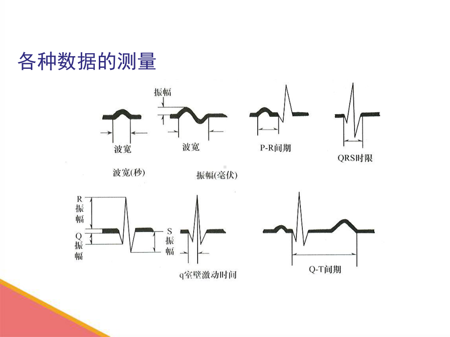 心电图基础知识1课件.ppt_第3页