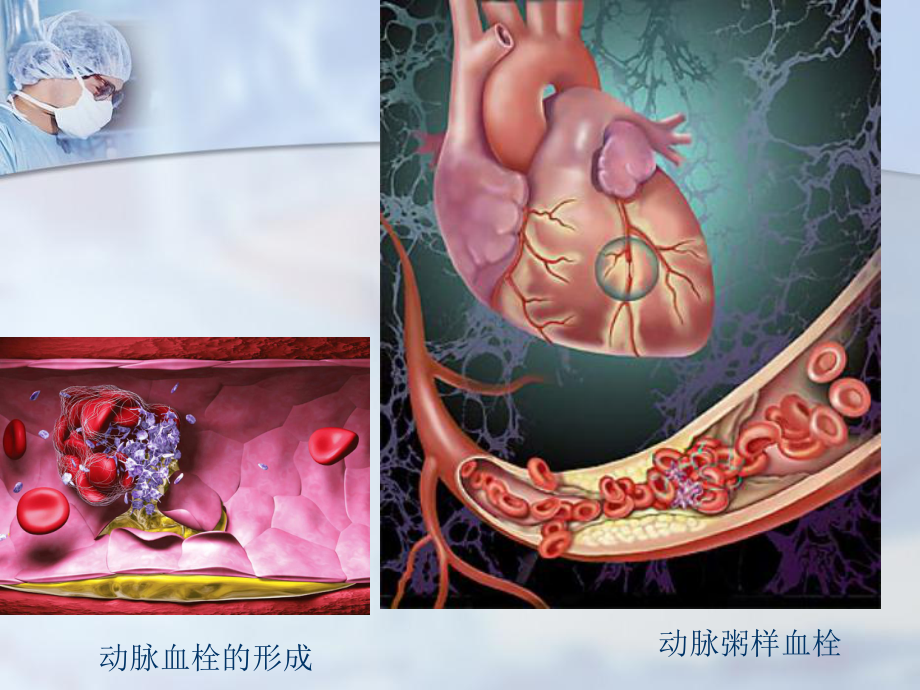 第二十七章作用于血液及造血系统药物课件.ppt_第3页