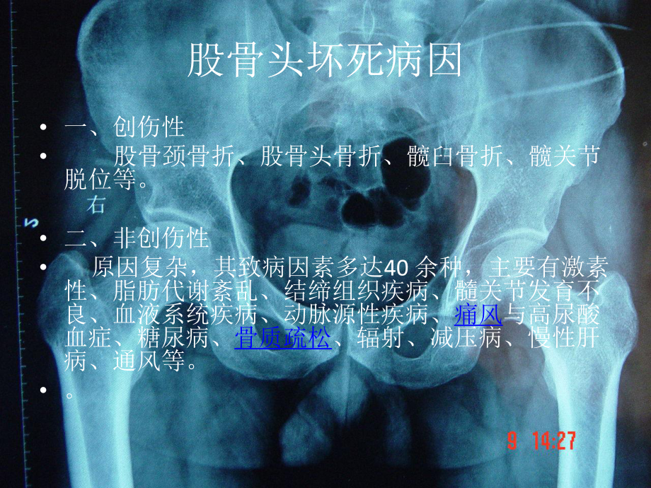 奈特解剖图谱课件.pptx_第3页