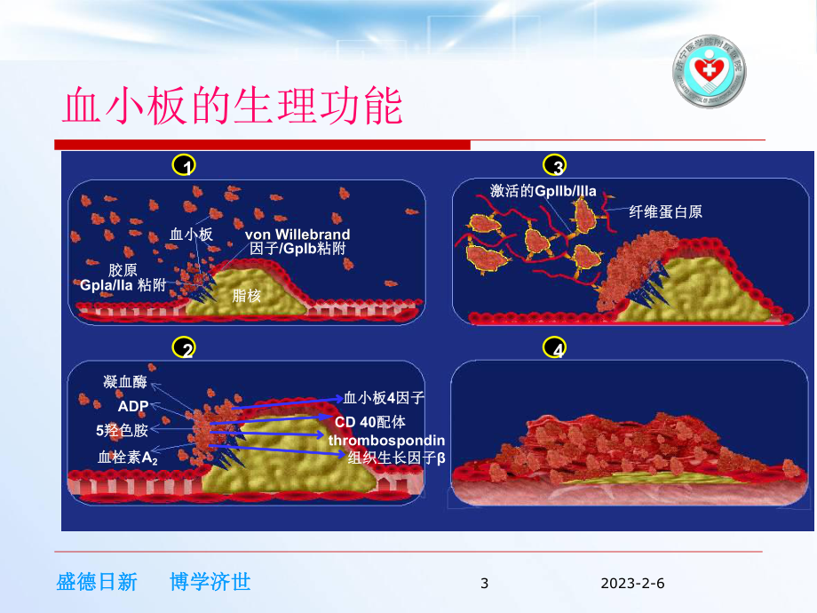 浅谈替罗非班在冠心病中的应用课件.ppt_第3页