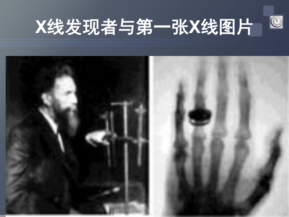 影像总论DR、CT、MR简介课件.ppt_第3页