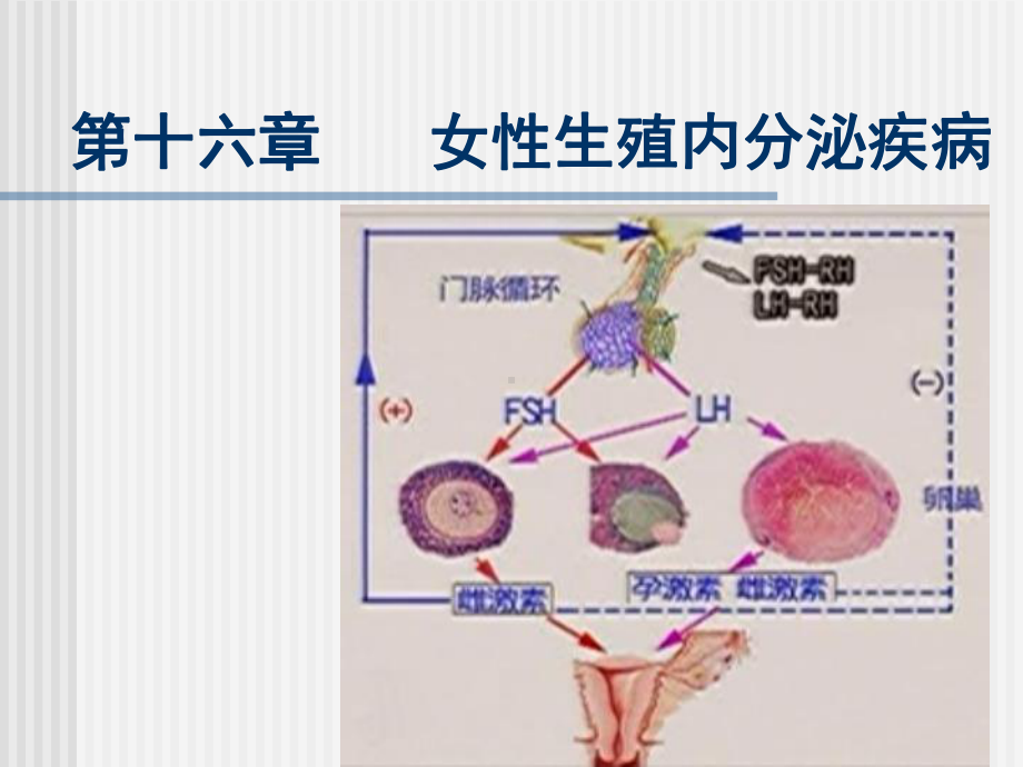 第十六章女性生殖内分泌疾病病人的护理课件.ppt_第1页