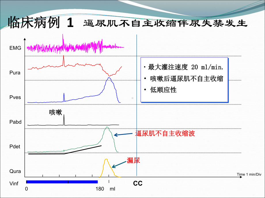 四川大学华西医院尿动力学课件.ppt_第3页