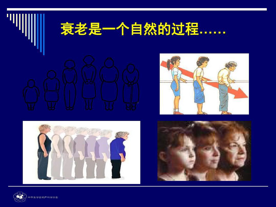 围绝经期管理科普版课件.ppt_第2页