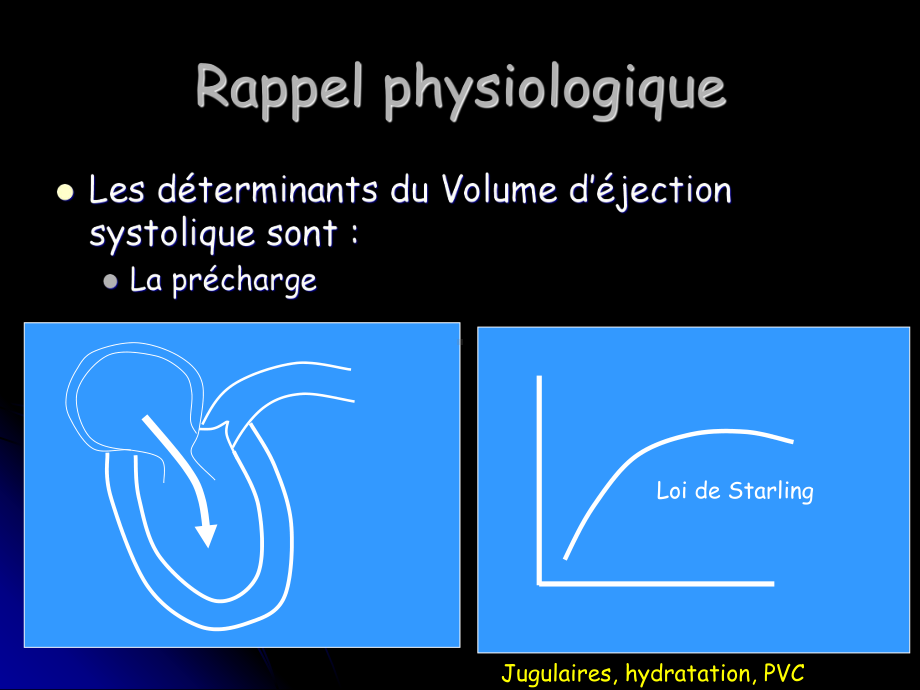 （体外膜肺ECMO课件）-Etats-de-choc.ppt_第3页